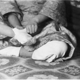 Chodidla se musela pravidelně převazovat a těsněji utahovat, aby se vešla do "lotosových botiček".