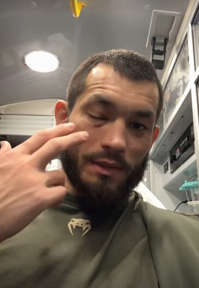 FOTO: Makhmud Muradov ukázal své zranění po nepříjemném dloubáku do oka. – stránka 99