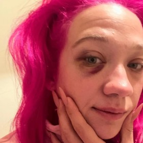 Tereza Mašková umístila začátkem roku 2024 na sociální sítě své fotografie s monoklem na obličeji.