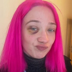 Zpěvačka Tereza Mašková chce varovat před poruchami příjmu potravy.