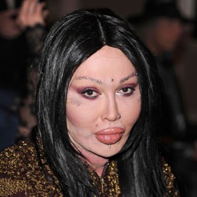 Přiznal, že podstoupil téměř tři stovky kosmetických procedur, včetně čtyř operací nosu, voperování dvou sad lícních implantátů a četná zvětšení rtů