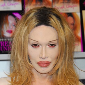 Kromě záliby v make-upu a parukách se naplno pustil do přeměny svého vzhledu pomocí skalpelu.