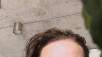 FOTO: Agáta Hanychová podstoupila zvětšení rtů.