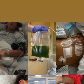 Její šance na přežití činila pouhých 10 procent s tím, že doživotně bude mít vývod a docházet na dialýzu. Nic z toho se naštěstí nepotvrdilo. Důsledky třítýdenního pobytu v nemocnici, kde lékaři bojovali o její život, ale Tereza pociťuje dodnes.