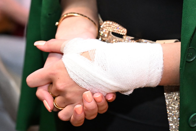 FOTO: Natálie Kočendová si zranila ruku. – stránka 89