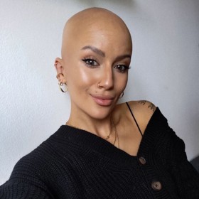 Modelka a šperkařka Barbora Kropáčková přišla před téměř dvěma lety v důsledku nemoci prsních implantátů o vlasy, řasy i obočí.