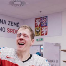 Jakub Krejčík a jeho zranění v obličeji po zásahu pukem.