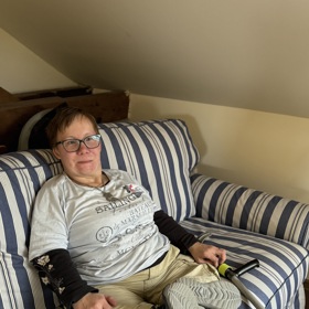 Osmatřicetiletá Simona Kofroňová se od narození potýká se vzácným genetickým onemocněním zvaným Robertsův syndrom.