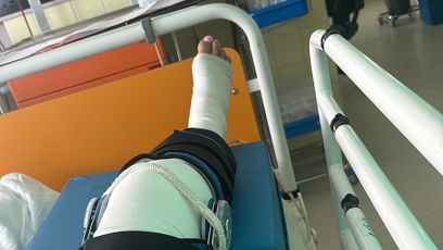 FOTO: Tereza je po operaci kolene.