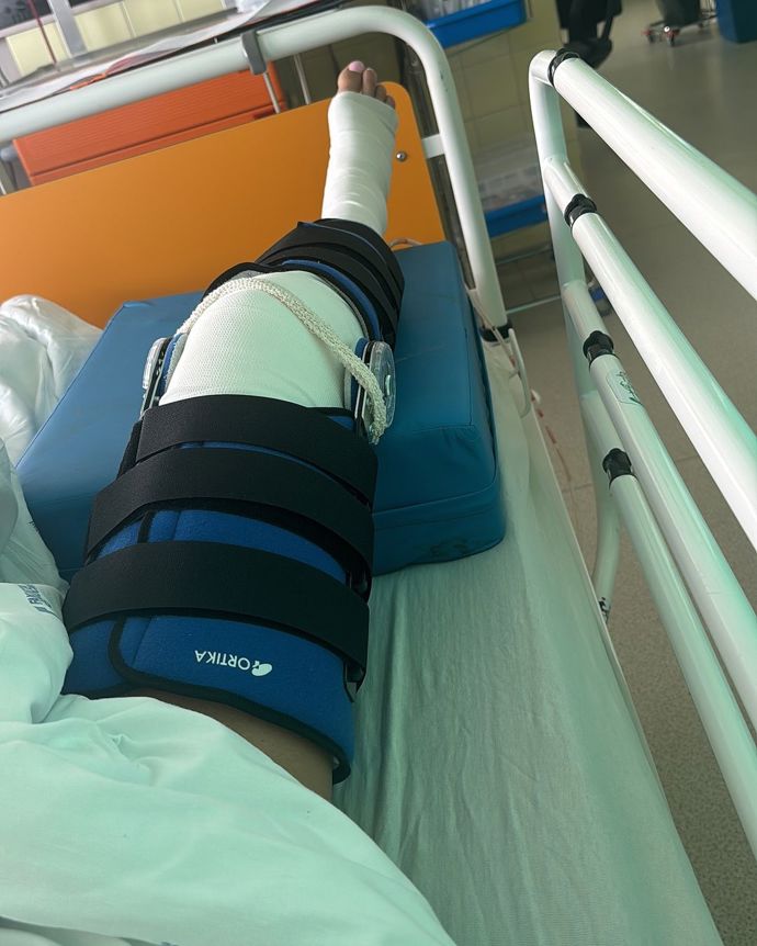 FOTO: Tereza je po operaci kolene. – stránka 16