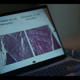 Snímky srdce Moniky a Klárky.