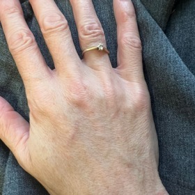 Efekt plasmového pera se Jana Horejšová rozhodla otestovat na kůži hřbetu ruky. Po několika měsících je rozdíl mezi oběma hřbety rukou jasně viditelný.