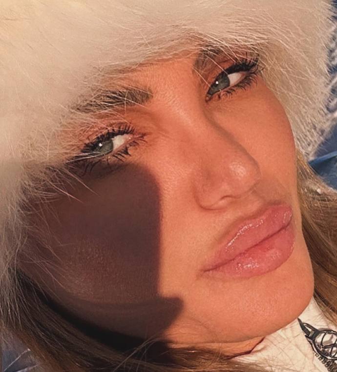 FOTO: Alena Pallová je dermatoložka celebrit. – stránka 7