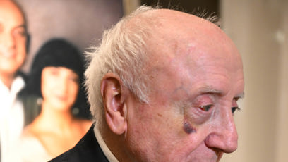 FOTO: Felix Slováček se postupně zbavuje svého monoklu.