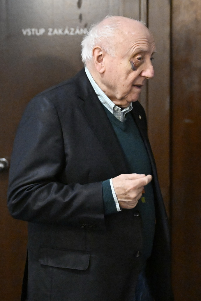 FOTO: Felix Slováček si poškodil sklivec v oku. – stránka 420