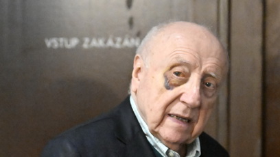 FOTO: Felix Slováček si poškodil sklivec v oku.