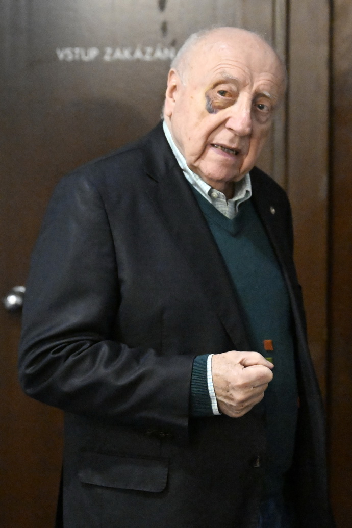 FOTO: Felix Slováček si poškodil sklivec v oku. – stránka 419