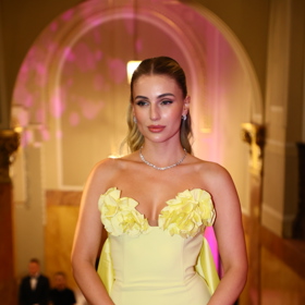 Karolína Mališová přiznala svým fanouškům na sociálních sítích, že ji dlouhé roky trápí vypadávání vlasů v důsledku alopecie - z jejího plesového účesu to ale patrné rozhodně nebylo!