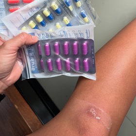 Hana Gelnarová má také infekci v koleni.