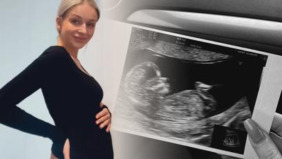 FOTO: Tereza Hlůšková se pochlubila těhotenským bříškem.