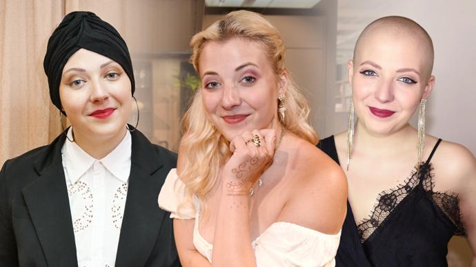 FOTO: Anička Slováčková vlivem nemoci přišla o vlasy. – stránka 260