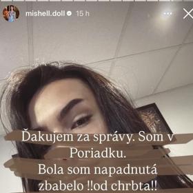 Michaela Doležalová se měla stát obětí napadení. 