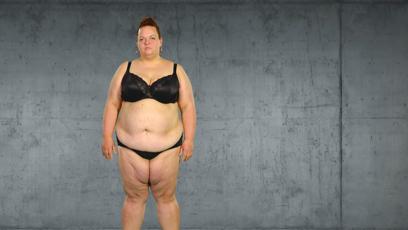 FOTO: Zuzana se ocitla ve stadiu extrémní obezity.