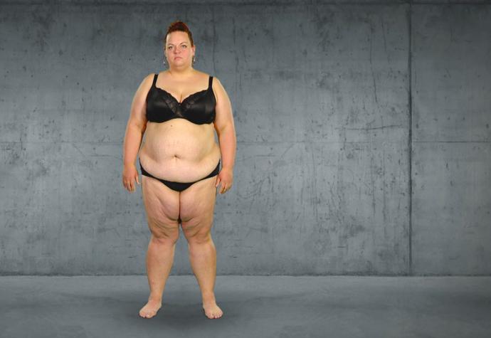 FOTO: Zuzana se ocitla ve stadiu extrémní obezity. – stránka 117