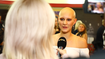 FOTO: Modelka Klárka bere alopecii jako přednost.