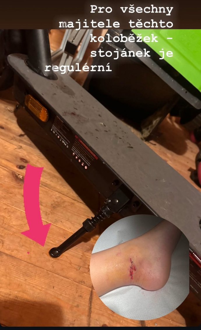 FOTO: Ben Vojtek skončil s roztrženou nohou.
