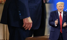 Donald trump má chronickou žilní nedostatečnost.