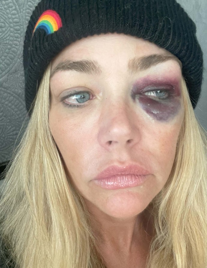 FOTO: Denise Richards měl údajně zmlátit její manžel Aaron Phypers. – stránka 2
