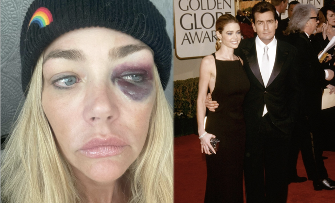 FOTO: Denise Richards má monokly.