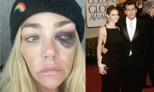 Denise Richards má monokly.