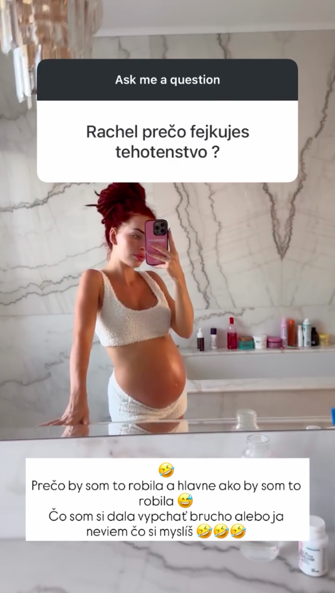 FOTO: Rachel údajně fejkuje těhotenství. – stránka 2