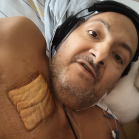 Patrik Hezucký má na hrudi zvláštní náplast. Jako by po zranění.