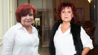 FOTO: Petra Janů měla před lety zničený obličej.