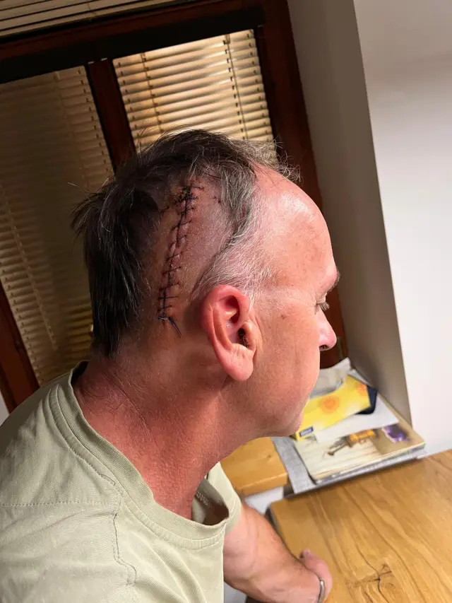 FOTO: Vnuk se ho často doptává na jizvu na hlavě.