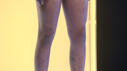 FOTO: Nohy soutěžícího.