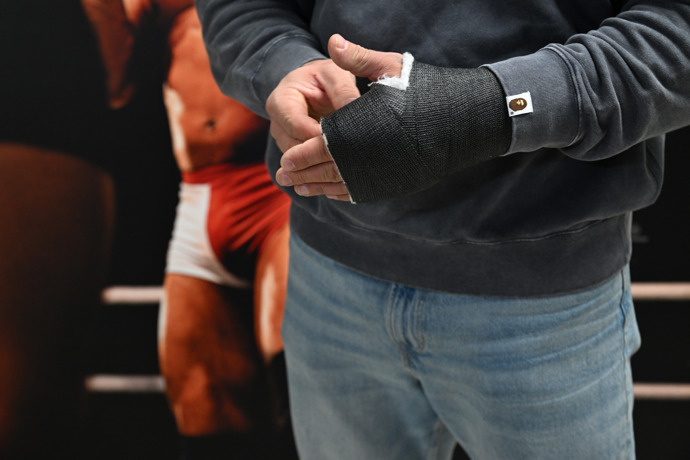 FOTO: Jakub Enžl má zlomenou ruku. – stránka 18