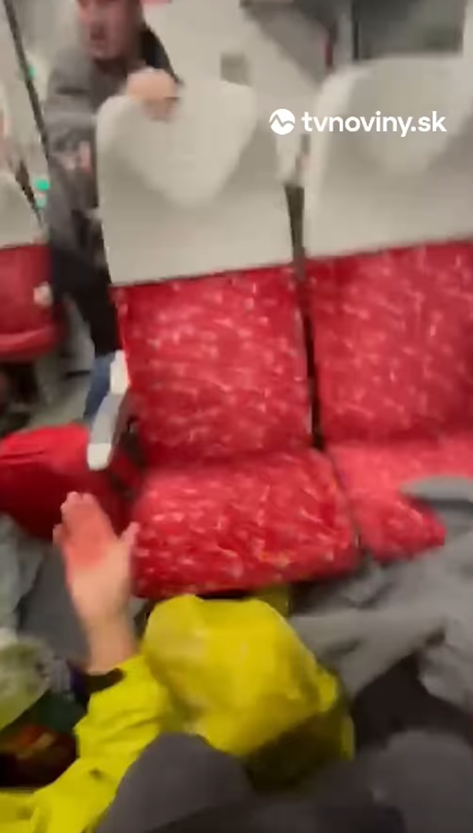 FOTO: Jedné ženě tekla krev z čela. – stránka 1