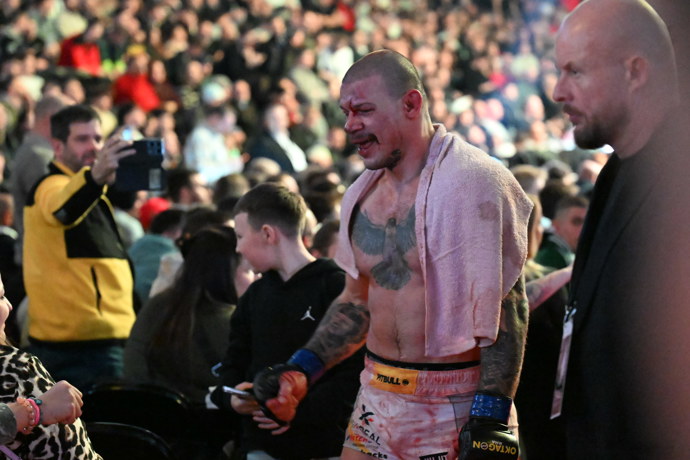 FOTO: Robert Pukač byl viditelně domlácený. – stránka 5