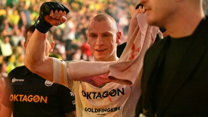 FOTO: Pavel Tóth má po zápase s Raškou zlomenou čelist.