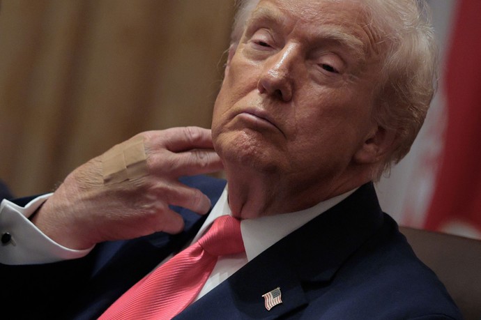 FOTO: Podivné náplasti na ruce Donalda Trumpa.