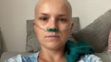 Můj boj s rakovinou: Bolela mě i kůže, nesnesla jsem dotyk ani obejmutí, líčí nežádoucí účinky chemoterapie Hanka Samsonova