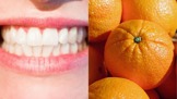 Zuby vám vybělí potraviny, u kterých byste to vůbec nečekali.
