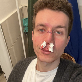 Daniel Krejčík nešťastně spadl.