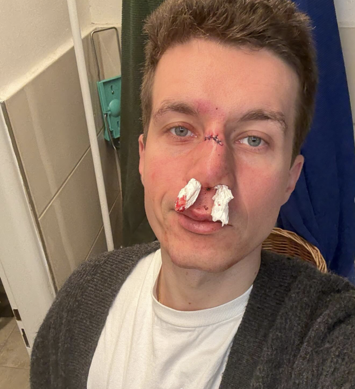 FOTO: Daniel Krejčík nešťastně spadl. – stránka 1