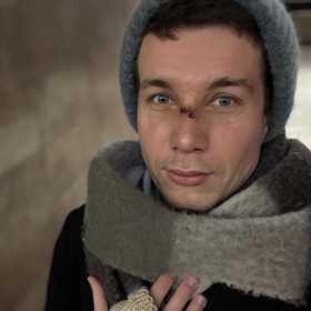 Daniel Krejčík si způsobil nepříjemné zranění.