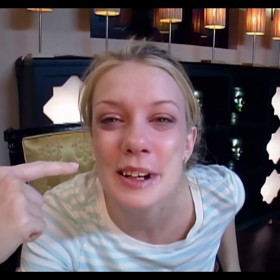 Několik dívek muselo podstoupit zbroušení zubů nebo úpravu mezer mezi zuby.